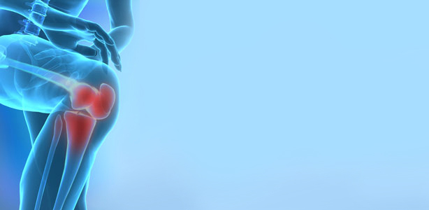 Εξατομικευμένη Αρθροπλαστική Γόνατος